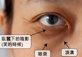 眼袋