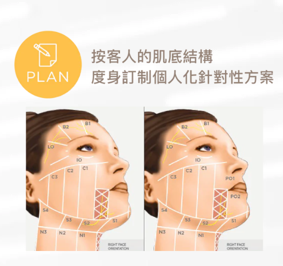 Ultherapy vs PRIME 新舊超聲刀大比拼：最新 2.0 版真係唔痛啲？一文睇清抗老原理與效果！插图3