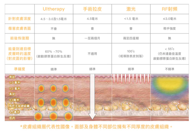 Ultherapy vs PRIME 新舊超聲刀大比拼：最新 2.0 版真係唔痛啲？一文睇清抗老原理與效果！插图4